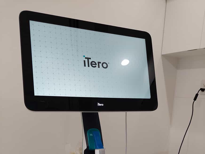 インビザライン 3D光学スキャナ iTero