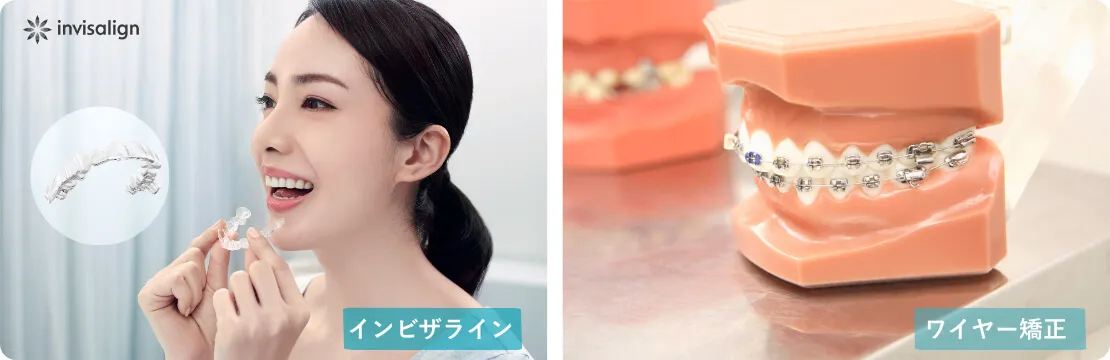 ワイヤー矯正とインビザラインの装着モデル模型